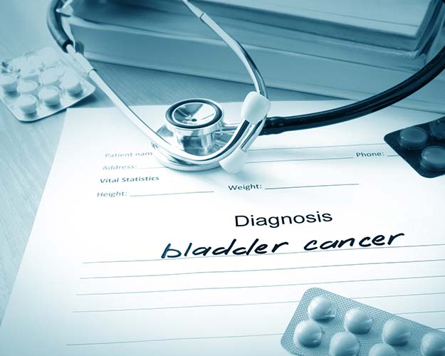 Bladder Cancer Diagnosis Note