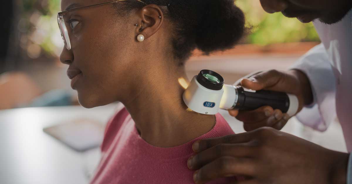 Woman with Dark Skin having Mole checked