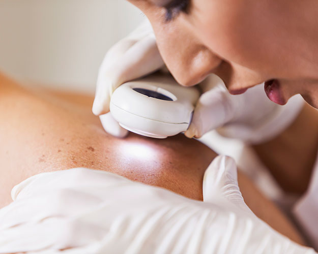 Skin Cancer Exam